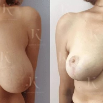 Владимир Александрович Косинец, Moscow Фото - 6