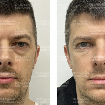 Евгений Викторович Лешунов, Москва Фото - 5