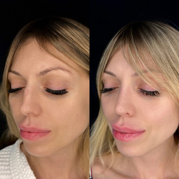 Александр Тимошенко, Saratov Фото - 5