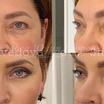 Юлия Шведова, Воронеж Фото - 5