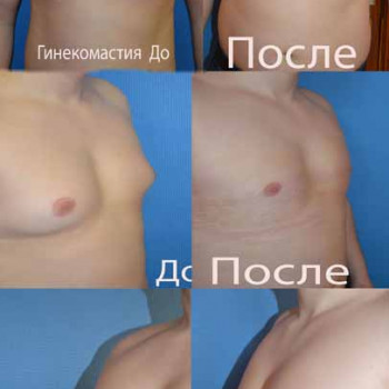 Самир Чавдаров, Voronezh Фото - 5