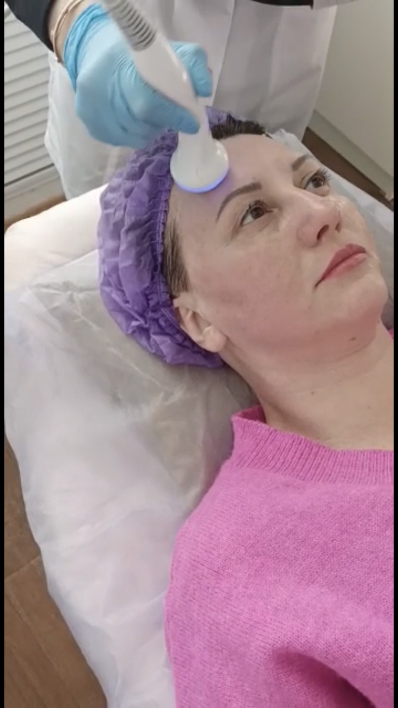 Криотерапия лица с гиалуроновой кислотой
                    Косметолог Ирина Боева Оренбург