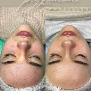 Liliana Taranchenko, Warsaw Фото - 5