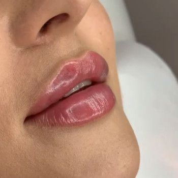 MB Beauty Clinic, Warsaw Фото - 5