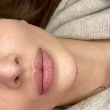 MB Beauty Clinic, Warsaw Фото - 6