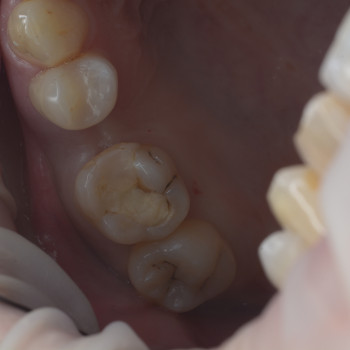 Арман Есенгелдиев, Almaty Фото - 5