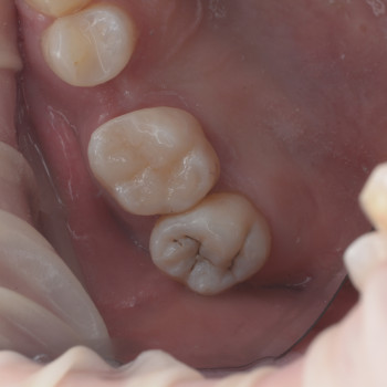 Арман Есенгелдиев, Almaty Фото - 6