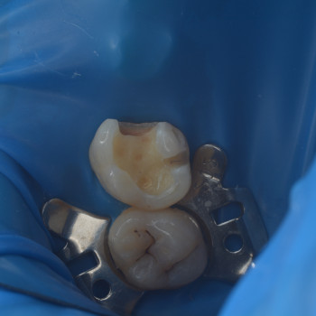 Арман Есенгелдиев, Almaty Фото - 7