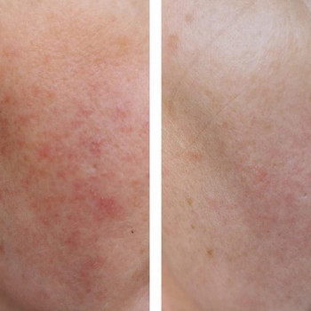 Lawenda, Варшава Фото - 5