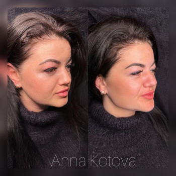 Anna Kotova, Berlin Фото - 5