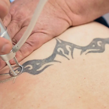 LaserÄsthetik, Berlin Фото - 6