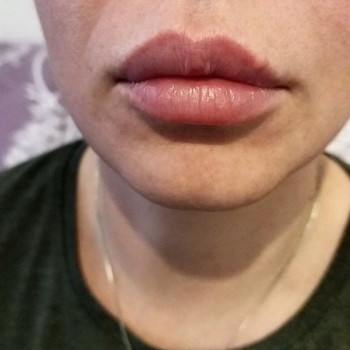 Albina Okulova, Berlin Фото - 5