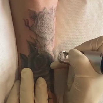 Stunning You, Berlin Фото - 5