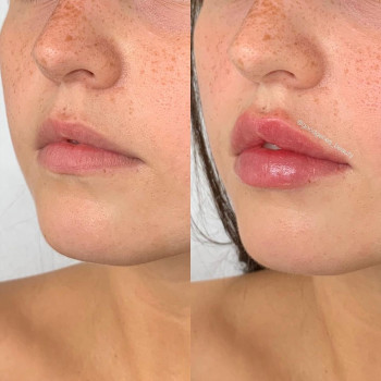 Good Genes, Berlin Фото - 5