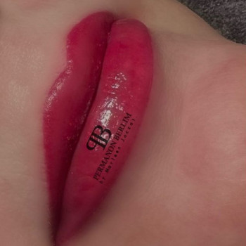 Permanon, Berlin Фото - 6