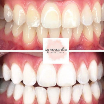 By Mervearslan, Berlin Фото - 5