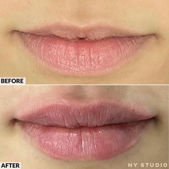 HY Studio, Berlin Фото - 6