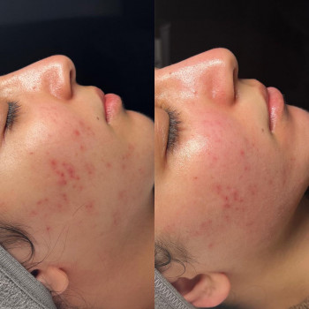 Ayla , Hamburg Фото - 6