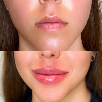 Svetlana Kolesnik, Hamburg Фото - 5