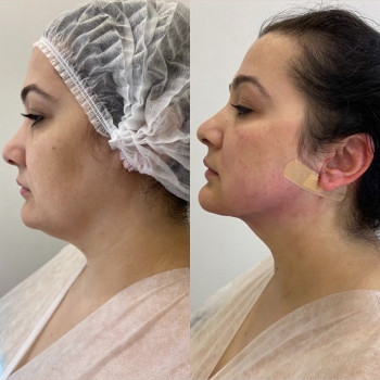 Tina Kuder, Hamburg Фото - 5