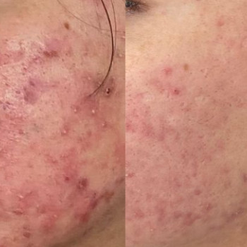 Neila , Hamburg Фото - 7