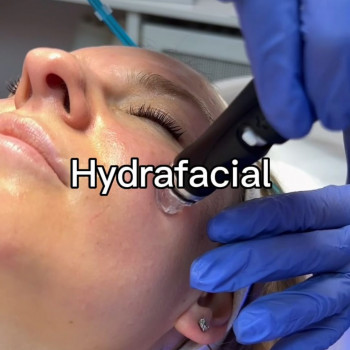 Чистка лица HydraFacial