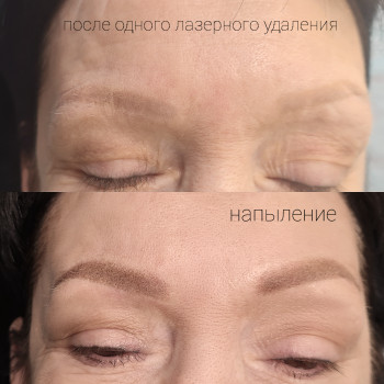 Перекрытие старого татуажа 