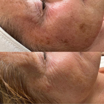 Beauty Bar, Hamburg Фото - 5