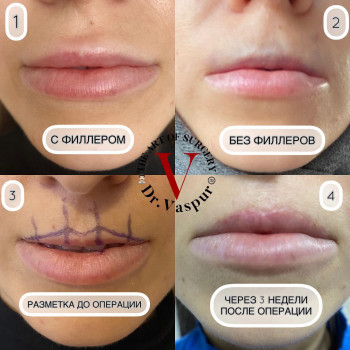 Vaspyr Ghuyumchyan, Hamburg Фото - 5