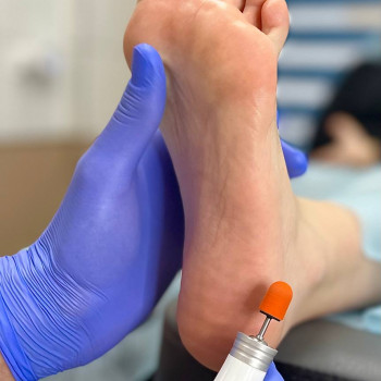 Медицинский педикюр