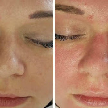 Elena Alfano, Wolfsburg Фото - 5