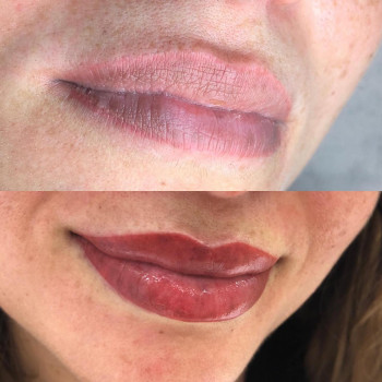 Pigmentation Academy, Frankfurt am Main Фото - 6