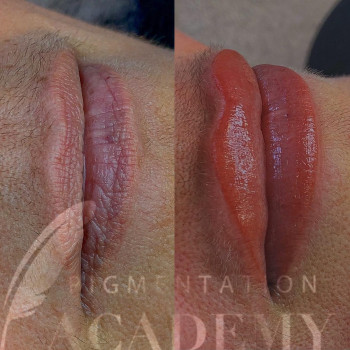 Pigmentation Academy, Frankfurt am Main Фото - 7