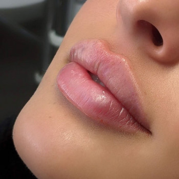 Helen Rozental, Frankfurt am Main Фото - 6