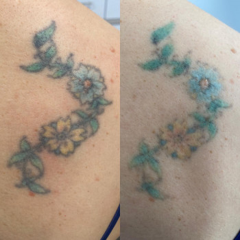 Achromatique, Freiburg Фото - 5