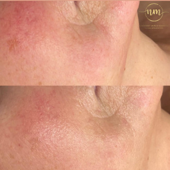 Natasha Kosmetik, Ludwigshafen am Rhein Фото - 5