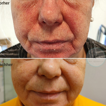 Kathas Place, Ludwigshafen am Rhein Фото - 5