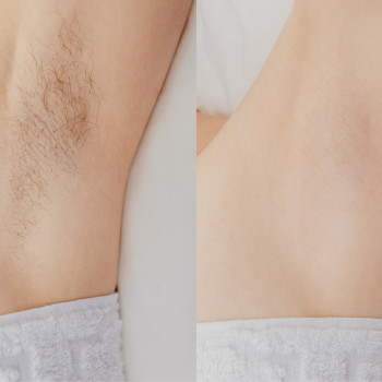 Laser Esthetics, Köln Фото - 5