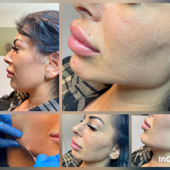 VitaWell, Köln Фото - 5