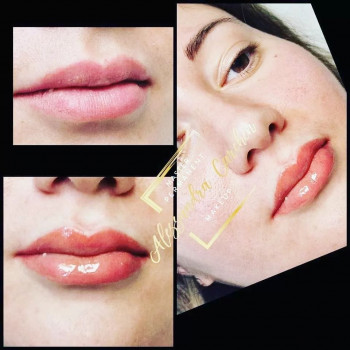 Alessandra Carchen, Milan Фото - 5