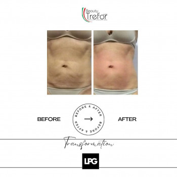 Beauty Trefor, Милан Фото - 5