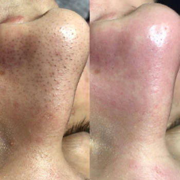 Anna Smehovskaya, Rome Фото - 5