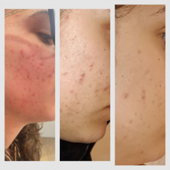 Pulsazione, Rome Фото - 5