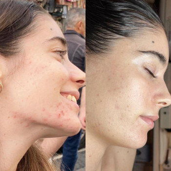 La Venere, Рим Фото - 5