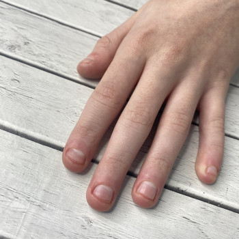 Маникюр подростку, который грызет ногти 