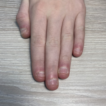 Фото До 
подростка