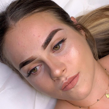 More PMU, Рим Фото - 5