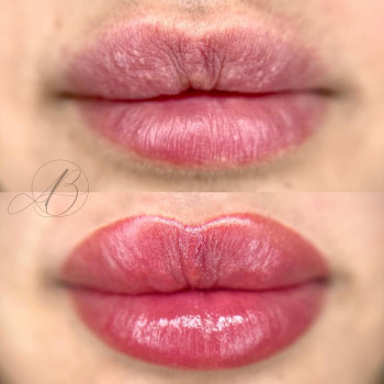 Anita Baglioni, Rome Фото - 5