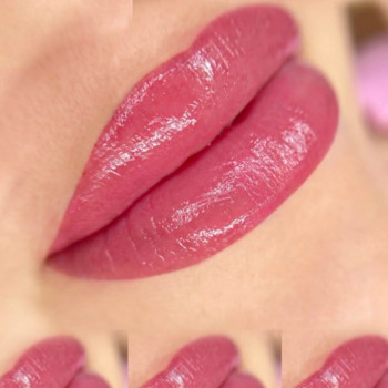 Магдалена Дзевечинская, Рим Фото - 5