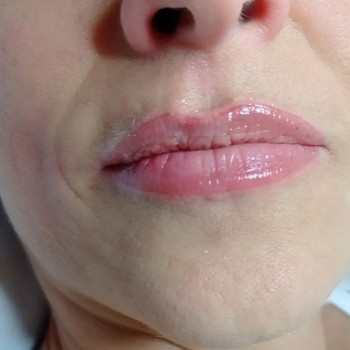 Oscar, Rome Фото - 5